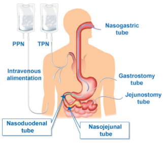 tube feeding anatomy